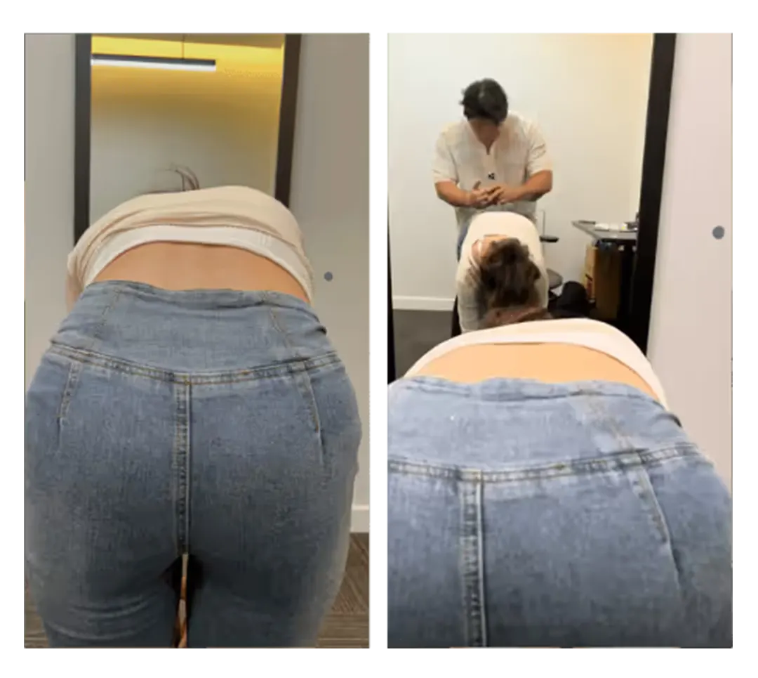 Posture before and after treatment — 