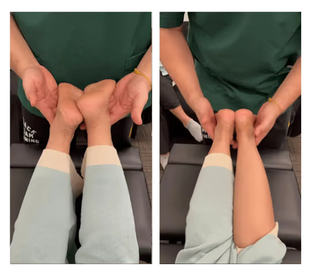 Posture before and after treatment — 