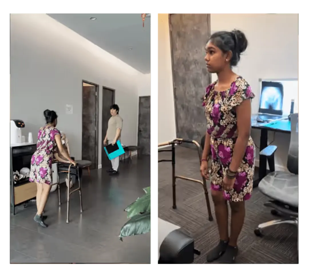 Posture before and after treatment — 