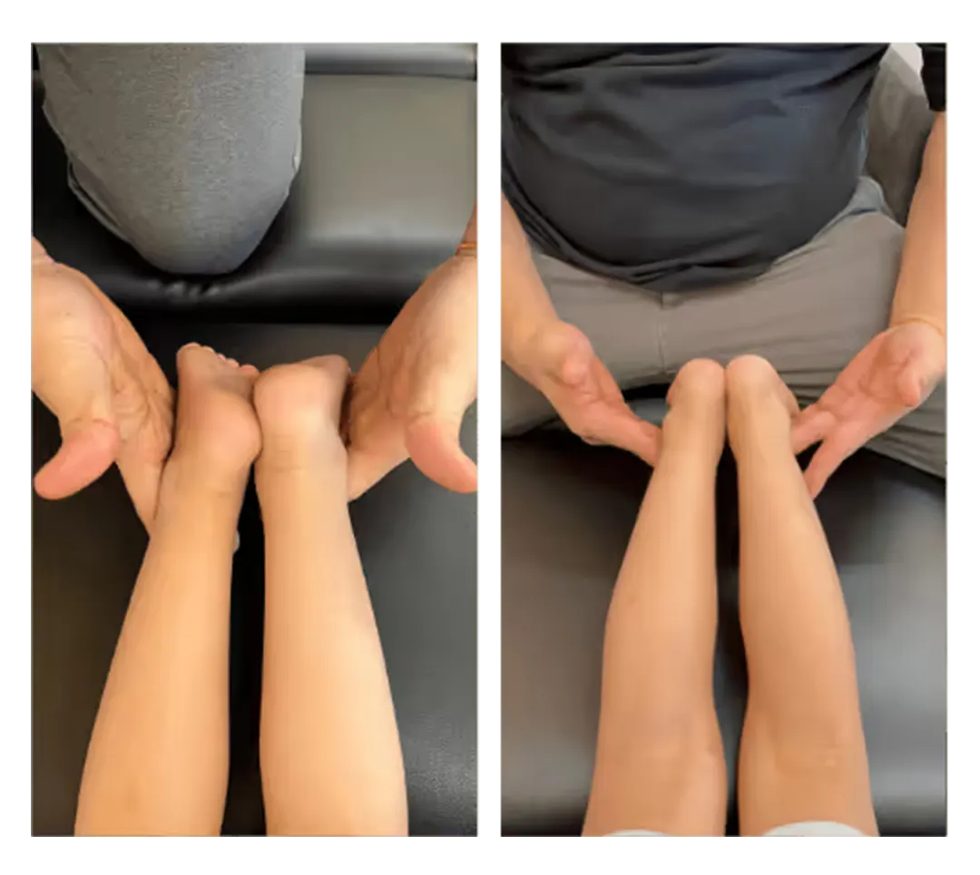Posture before and after treatment — 