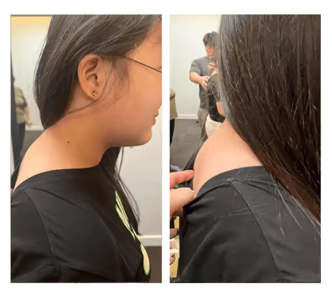 Posture before and after treatment — 