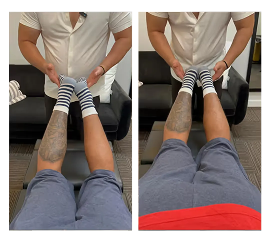Posture before and after treatment — 